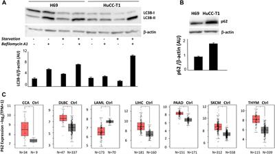 Autophagy impairment in human bile duct carcinoma cells